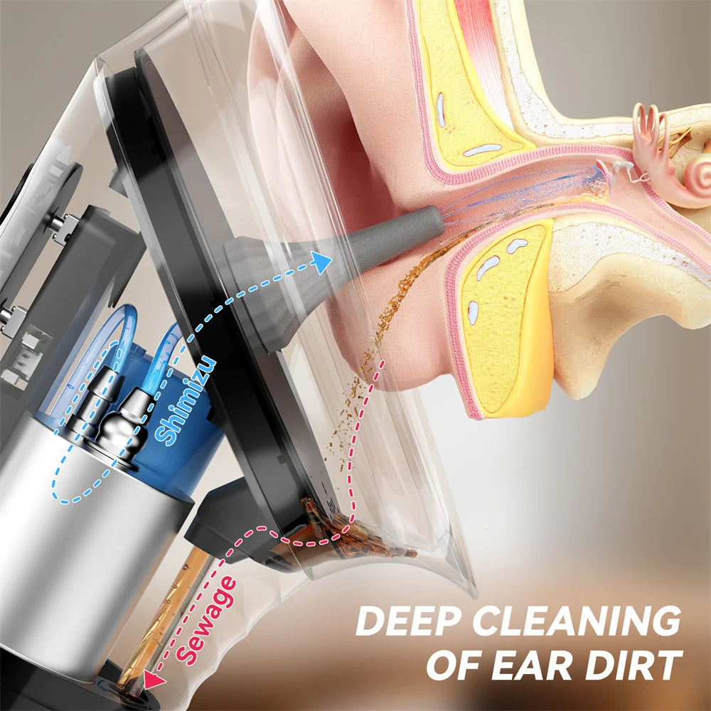 Electric Ear Irrigation Cleaning Kit with Dual Water Tanks